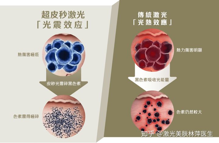 图.传统与超皮秒激光作用原理对比